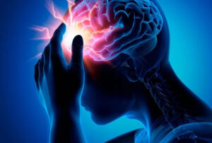 Лечение глиобластомы в Израиле