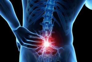 Лечение метастазов позвоночника в Израиле