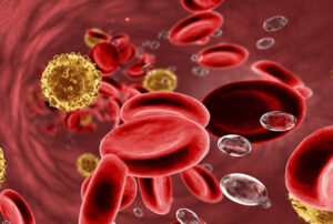 Лечение острого лейкоза в Израиле