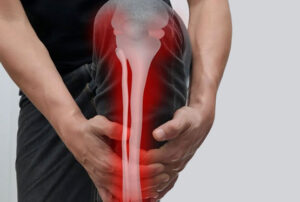 Лечение хондромы в Израиле