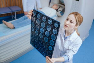 Лечение кисты головного мозга в Израиле